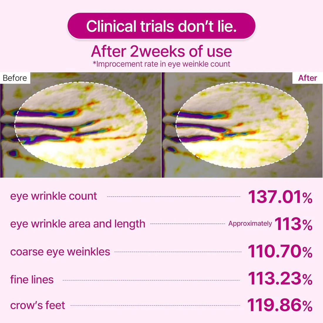 CALCIUM VOLUME BALM + 60EA COLLAGEN EYE PATCH