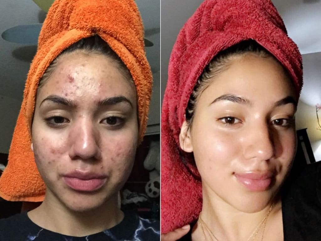GLASS SKIN PREMIUM KIT (6 pcs)™