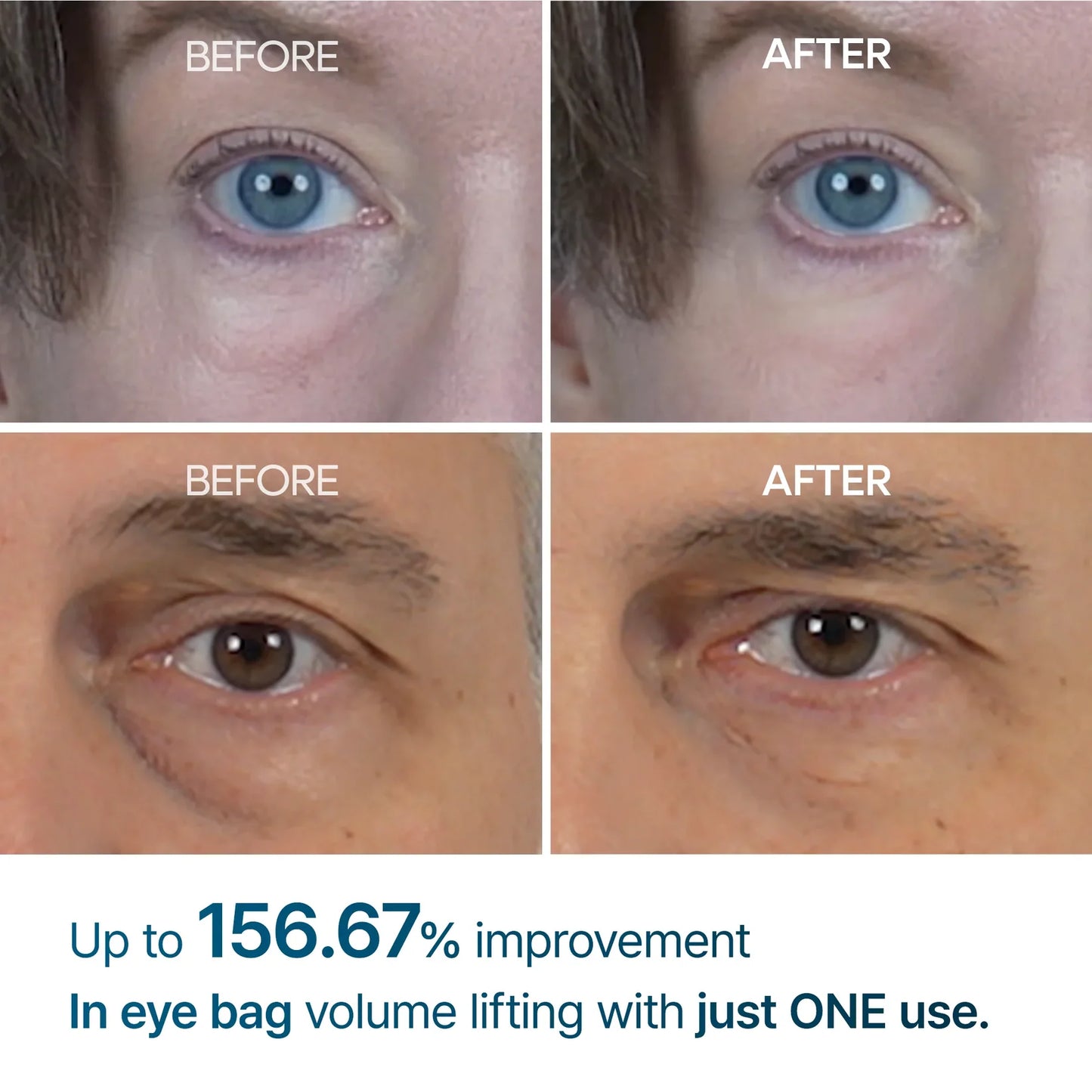 Eyephalt Eyebag Cream™ - Instant Firming