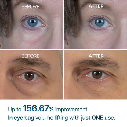 Eyephalt Eyebag Cream™ - Instant Firming