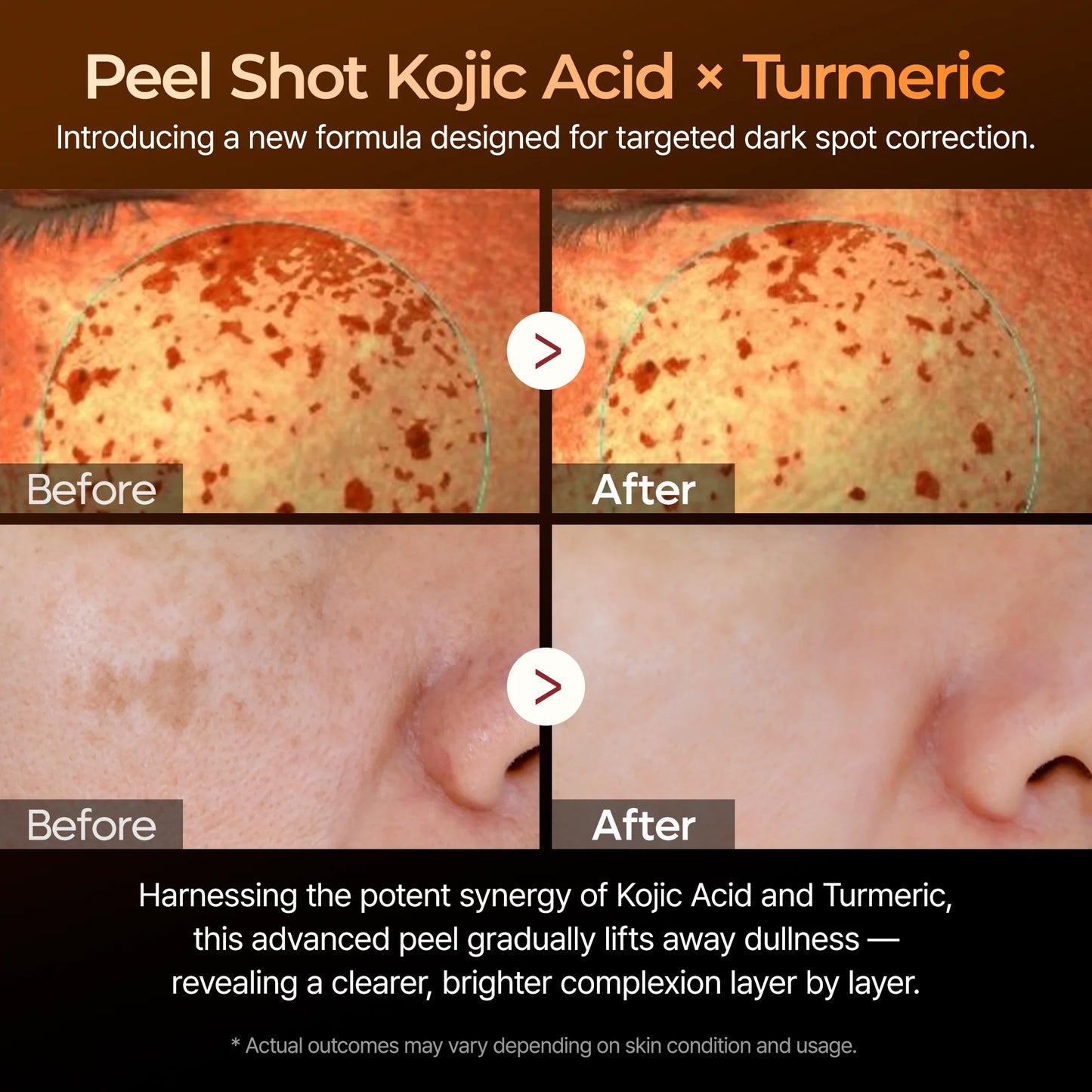 Keratin Kojic Acid Turmeric™ Serum - Face Exfoliator