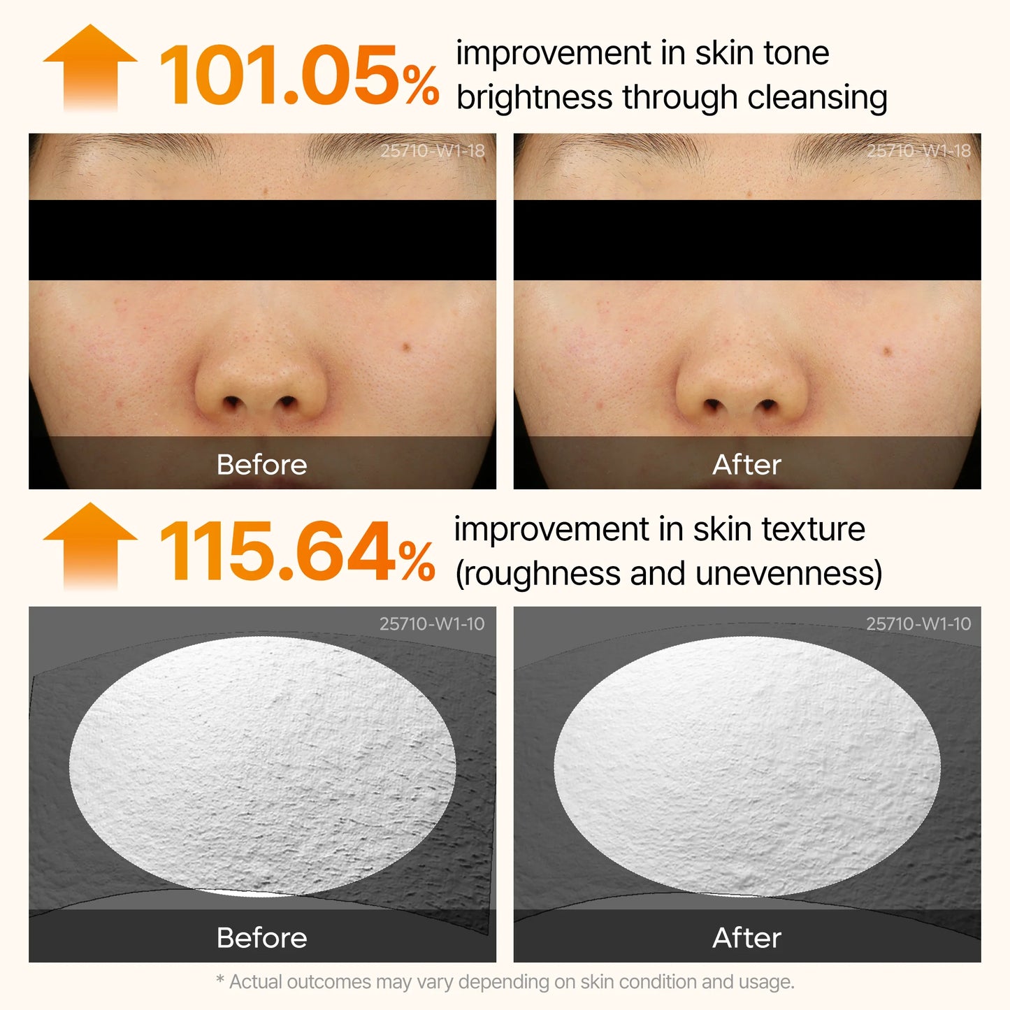 Keratin Kojic Acid Turmeric™ Serum - Face Exfoliator