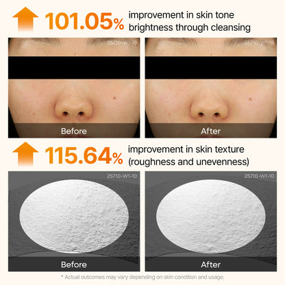 Keratin Kojic Acid Turmeric™ Serum - Face Exfoliator