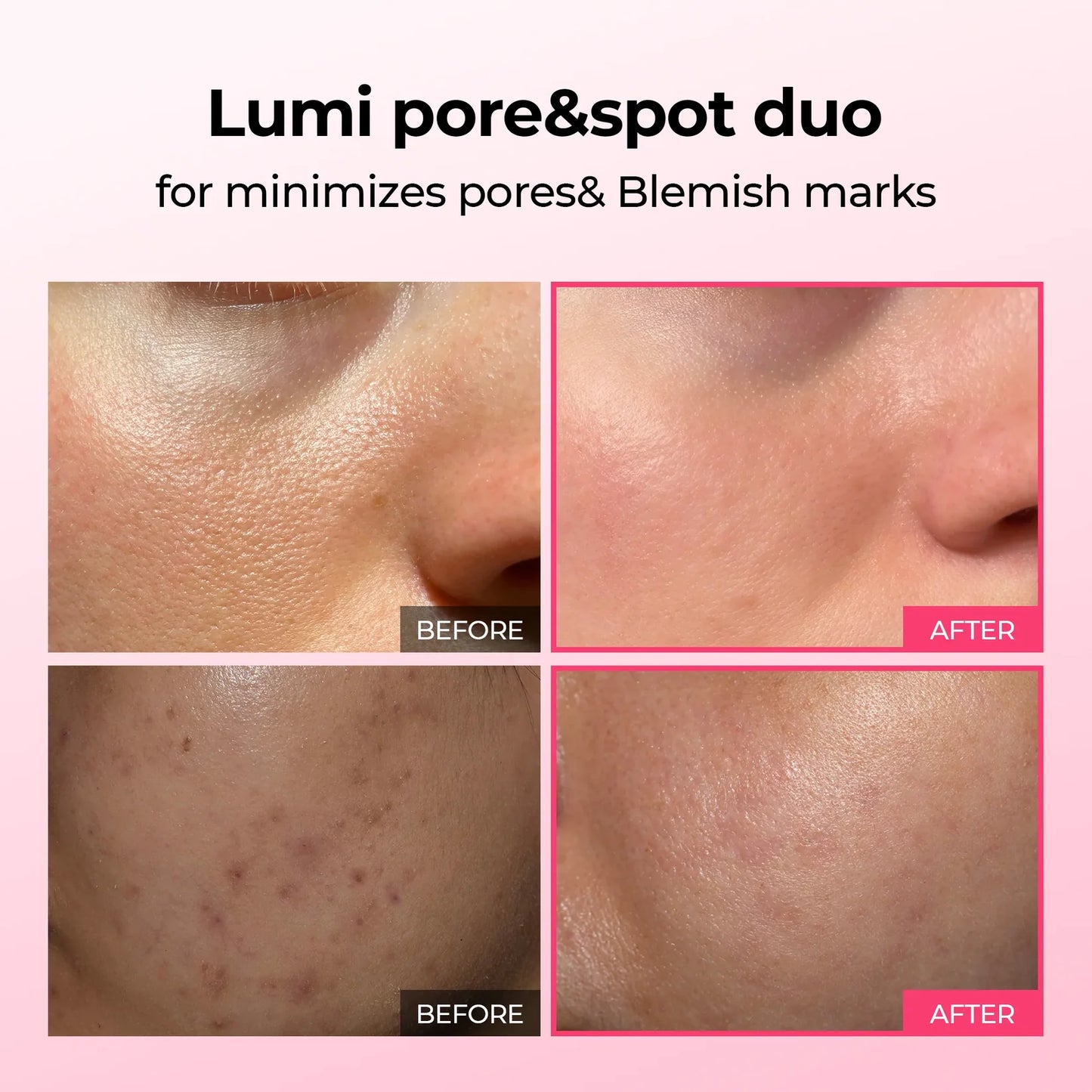 Pore & Spot™ Duo Care - Shrink Pores, Collagen Boost, Even Skin Tone