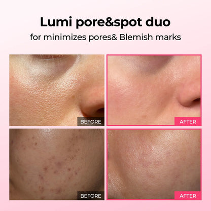 Pore & Spot™ Duo Care - Shrink Pores, Collagen Boost, Even Skin Tone