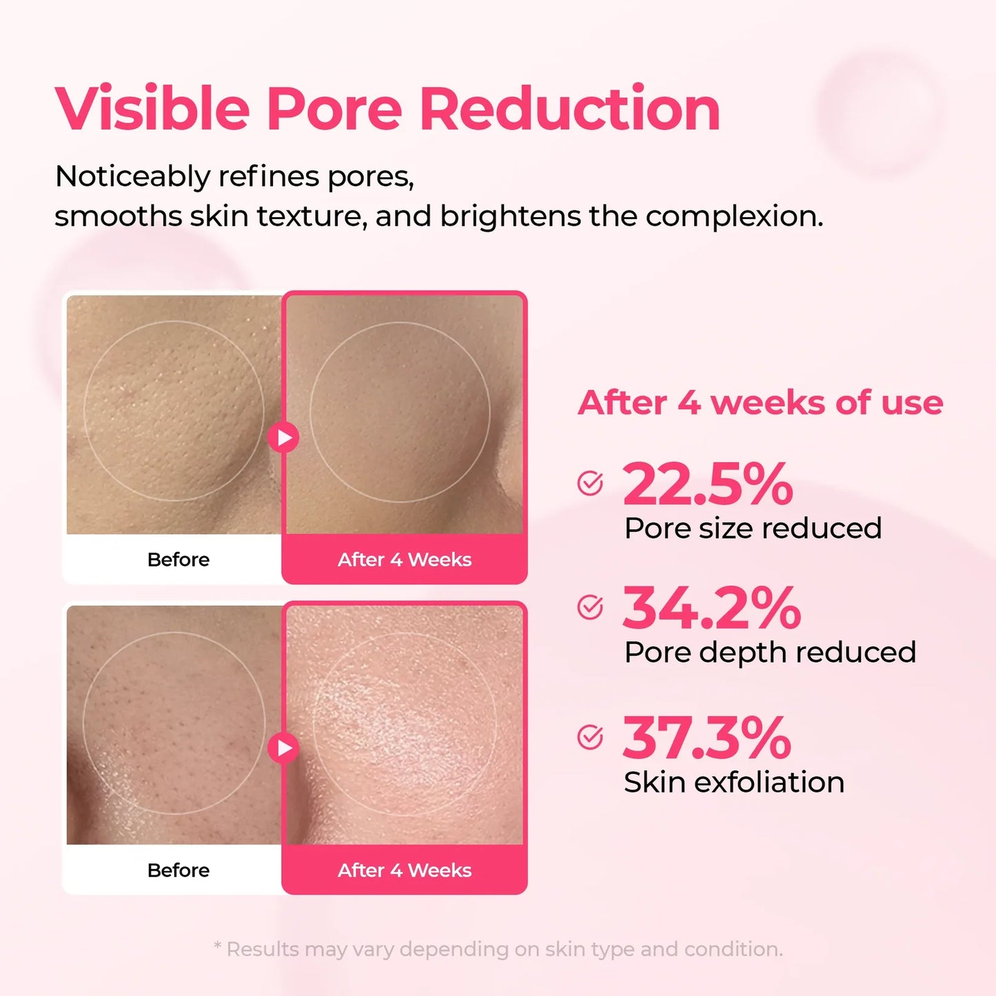Pore & Spot™ Duo Care - Shrink Pores, Collagen Boost, Even Skin Tone