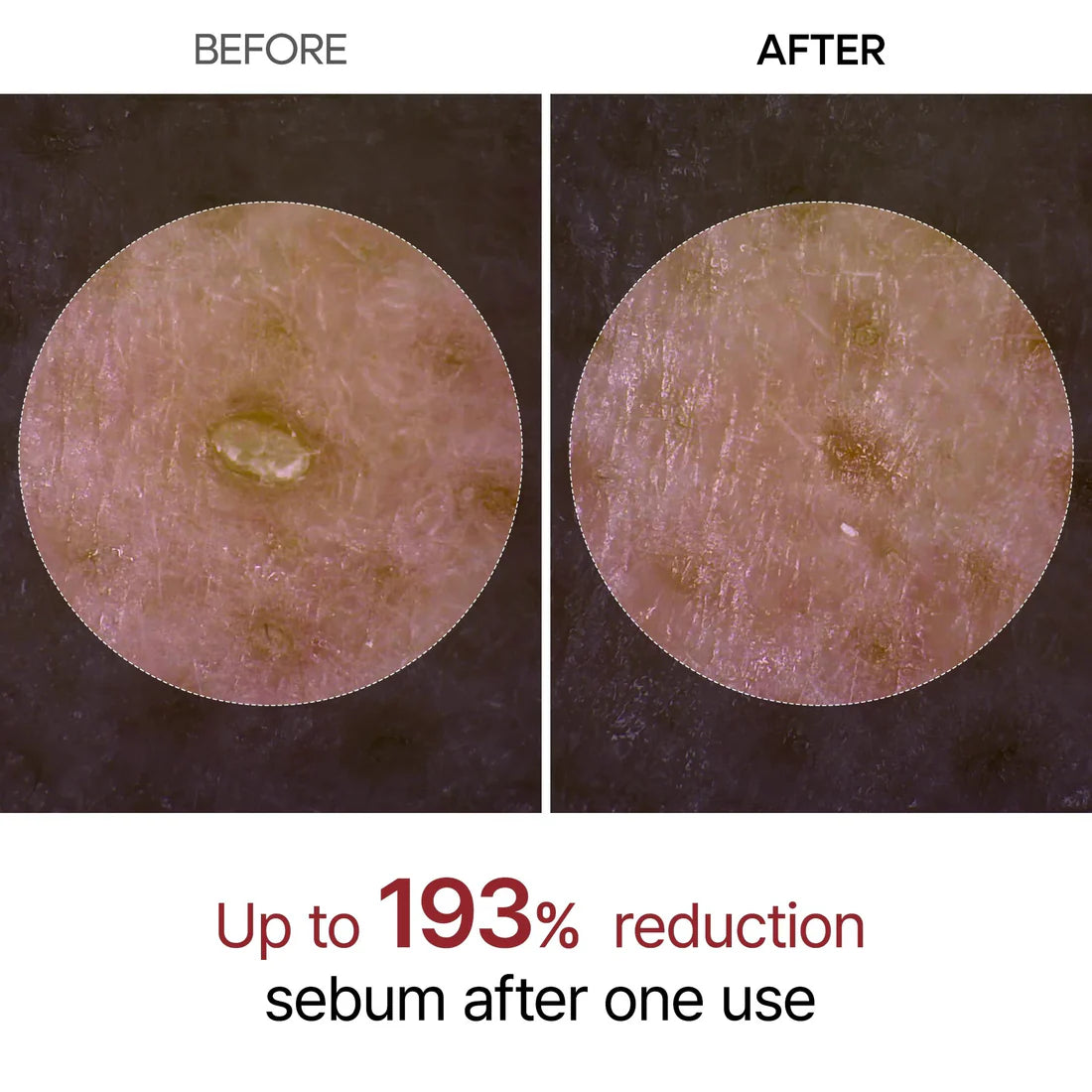 RICE PEEL SHOT SERUM AMPOULE - DR.MELAXIN™