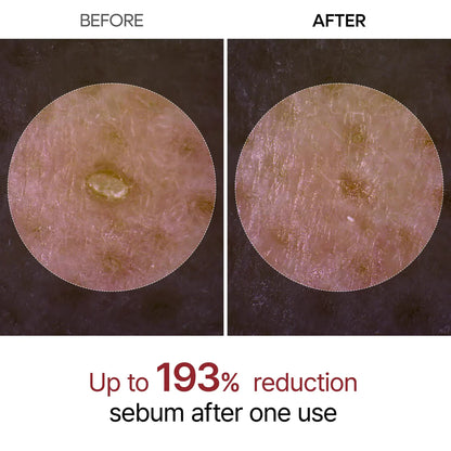 RICE PEEL SHOT SERUM AMPOULE - DR.MELAXIN™
